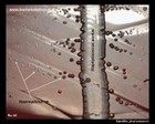 Haemophilus satellite phenomenon